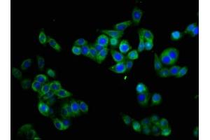Immunofluorescence staining of PC-3 cells with ABIN7160347 at 1:133, counter-stained with DAPI. (CHRM3 antibody  (AA 253-492))