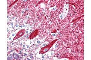 Anti-CPE antibody IHC of human brain, cerebellum. (CPE antibody  (AA 36-85))