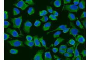 IF analysis of ACADM/MCAD using anti-ACADM/MCAD antibody (ABIN7601543). (Medium-Chain Specific Acyl-CoA Dehydrogenase, Mitochondrial (MCAD) (AA 38-401) antibody)
