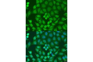 Immunofluorescence analysis of U2OS cells using ZFYVE16 antibody (ABIN6129169, ABIN6150439, ABIN6150441 and ABIN6223717) at dilution of 1:100. (ZFYVE16 antibody  (AA 1-280))