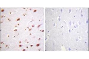 Immunohistochemistry analysis of paraffin-embedded human brain, using Catenin-delta1 (Phospho-Tyr228) Antibody. (CTNND1 antibody  (pTyr228))