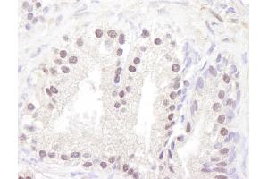 Immunohistochemistry (IHC) image for anti-Ataxia Telangiectasia Mutated (ATM) (AA 2550-2600) antibody (ABIN7453954)