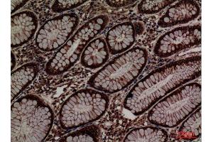 Immunohistochemistry (IHC) image for anti-Protein Disulfide Isomerase Family A, Member 3 (PDIA3) (Internal Region) antibody (ABIN6280937)