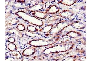 Immunohistochemistry of paraffin-embedded human kidney tissue using ABIN7152982 at dilution of 1:100 (FAK antibody  (AA 363-464))