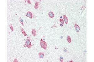 Anti-HEXA antibody IHC staining of human brain, cortex. (Hexosaminidase A antibody  (AA 142-170))