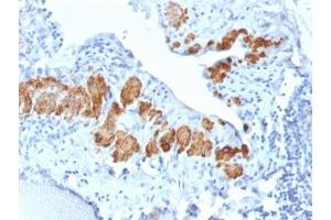 IHC testing of FFPE human breast tissue with recombinant SMMHC antibody (clone MYH11/2303R).