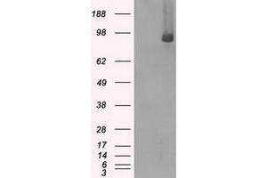 HEK293T cells were transfected with the pCMV6-ENTRY control (Left lane) or pCMV6-ENTRY BRAF (Right lane) cDNA for 48 hrs and lysed. (BRAF antibody)