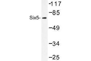 Image no. 1 for anti-Homeobox protein SIX5 (SIX5) antibody (ABIN317916) (Six5 antibody)