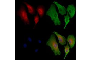 ABIN6258462 and ABIN6273867 staining  cells by IF/ICC. (GPER antibody  (C-Term))