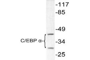 Image no. 1 for anti-CCAAT/enhancer Binding Protein (C/EBP), alpha (CEBPA) antibody (ABIN271872) (CEBPA antibody)