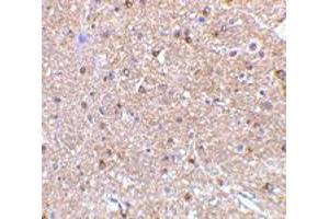Immunohistochemistry of RTN4 in mouse brain tissue with RTN4 polyclonal antibody  at 2.