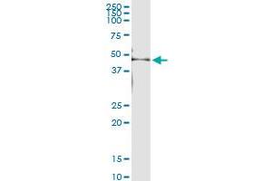 Immunoprecipitation of KRT35 transfected lysate using anti-KRT35 MaxPab rabbit polyclonal antibody and Protein A Magnetic Bead , and immunoblotted with KRTHA5 MaxPab mouse polyclonal antibody (B01) . (Keratin 35 antibody  (AA 1-455))