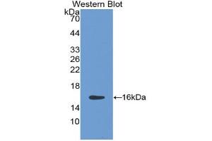 Western blot analysis of the recombinant protein. (HTRA1 antibody  (AA 10-146))