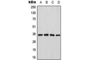 Western blot analysis of Cathepsin H expression in Jurkat (A), K562 (B), mouse kidney (C), PC12 (D) whole cell lysates. (Cathepsin H antibody  (Center))