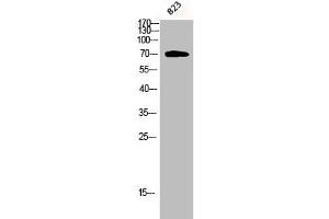 Western Blot analysis of 823 cells using Phospho-PKC ζ (T410) Polyclonal Antibody (PKC zeta antibody  (pThr410))