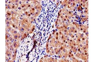 Immunohistochemistry (IHC) image for anti-ADAM Metallopeptidase with Thrombospondin Type 1 Motif, 4 (ADAMTS4) (AA 213-319) antibody (ABIN7142886)