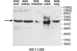 Western blot analysis of various fetal tissue, using AMN antibody. (AMN antibody  (Middle Region))