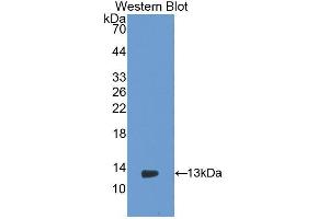 Western blot analysis of the recombinant protein. (PIGR antibody  (AA 343-447))