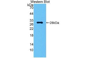 Detection of Recombinant CA2, Gallus using Polyclonal Antibody to Carbonic Anhydrase II (CA2) (CA2 antibody  (AA 1-260))