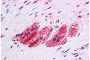 Human Colon, Myenteric Plexus: Formalin-Fixed, Paraffin-Embedded (FFPE) (SEPN1 antibody  (C-Term))