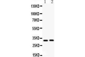 Anti- IL1beta antibody, Western blotting All lanes: Anti IL1beta  at 0. (IL-1 beta antibody  (C-Term))