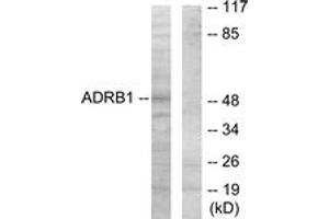 Western blot analysis of extracts from HT-29 cells, using ADRB1 Antibody. (ADRB1 antibody  (AA 281-330))