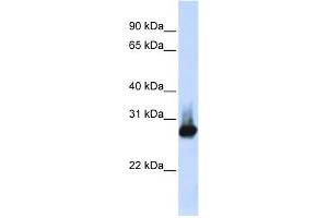 BCAP31 antibody used at 1 ug/ml to detect target protein.