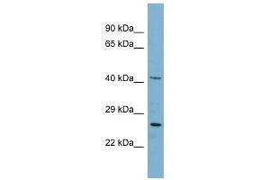 MRPS2 antibody used at 1 ug/ml to detect target protein.