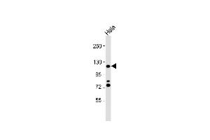 Anti-HIRA Antibody (N-term) at 1:1000 dilution + Hela whole cell lysate Lysates/proteins at 20 μg per lane. (HIRA antibody  (N-Term))