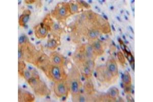 #VALUE! (Hexosaminidase A antibody  (AA 319-528))