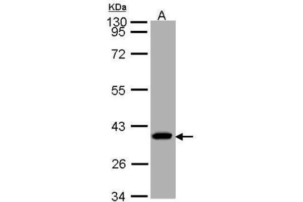 SUCLG1 antibody
