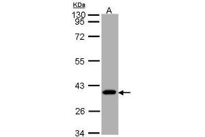 WB Image Sample (30 ug of whole cell lysate) A: A431 10% SDS PAGE antibody diluted at 1:1000 (SUCLG1 antibody)