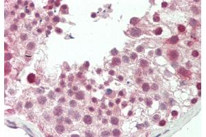 Rabbit Anti-RARG antibody  Formalin Fixed Paraffin Embedded Tissue: Human Testis Primary antibody Concentration: 1:66. (Retinoic Acid Receptor gamma antibody  (Middle Region))