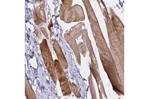 Immunohistochemical staining of human skeletal muscle with HAPLN2 polyclonal antibody ( Cat # PAB28323 ) shows strong cytoplasmic positivity in myocytes.