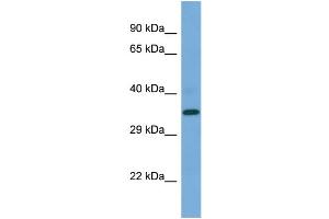 Western Blotting (WB) image for anti-Presenilin 2 (Alzheimer Disease 4) (PSEN2) (C-Term) antibody (ABIN2787885) (Presenilin 2 antibody  (C-Term))