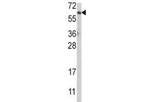Western blot analysis of anti-AKT antibody and MCF-7 lysate. (AKT1 antibody  (AA 49-76))