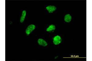 Immunofluorescence of purified MaxPab antibody to ZNF302 on HeLa cell. (ZNF302 antibody  (AA 1-399))