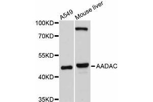 Western blot analysis of extracts of various cell lines, using AADAC antibody (ABIN4902801) at 1:1000 dilution. (AADAC antibody)