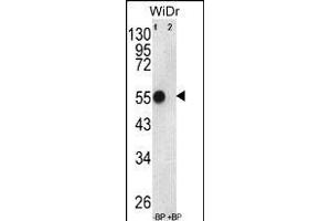 Western blot analysis of ATP5B Antibody (Center) Pab (ABIN650786 and ABIN2839558) pre-incubated without(lane 1) and with(lane 2) blocking peptide in WiDr cell line lysate. (ATP5B antibody  (AA 135-163))