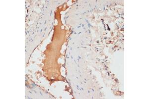 Immunohistochemistry of paraffin-embedded human lung using  antibody (ABIN6127360, ABIN6137012, ABIN6137013 and ABIN6221266) at dilution of 1:100 (40x lens). (APOC1 antibody  (AA 1-83))