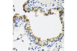 Immunohistochemistry of paraffin-embedded mouse lung using ST6G antibody (ABIN6130083, ABIN6148536, ABIN6148538 and ABIN6221427) at dilution of 1:100 (40x lens). (ST6GAL1 antibody  (AA 27-200))