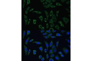 Immunofluorescence (IF) image for anti-AE Binding Protein 1 (AEBP1) (AA 999-1158) antibody (ABIN7265509)
