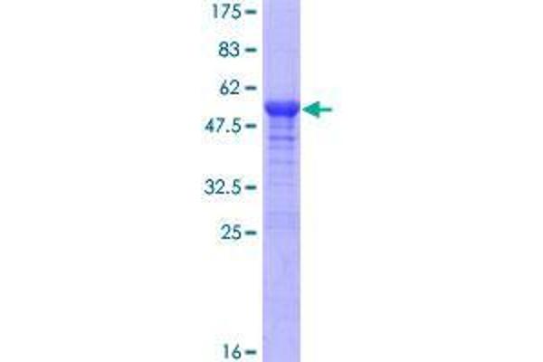 RAD54B Protein (AA 1-158) (GST tag)