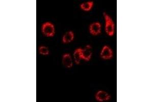 Immunofluorescent analysis of NDRG1 staining in SW480 cells. (NDRG1 antibody)
