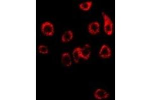 Immunofluorescent analysis of NDRG1 staining in SW480 cells.
