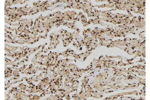 ABIN6272437 at 1/100 staining Human lung tissue by IHC-P. (ZNF280A antibody  (C-Term))