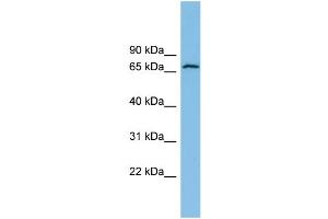 WB Suggested Anti-GLUD2 Antibody Titration: 0.