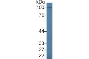 Western Blot; Sample: Human BXPC3 cell lysate; Primary Ab: 1. (IL17RA antibody  (AA 377-534))