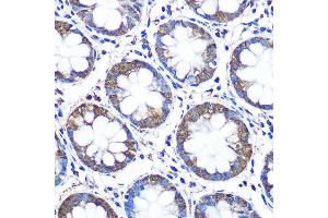 Immunohistochemistry of paraffin-embedded human colon using WISP2 Rabbit pAb (ABIN6128929, ABIN6150227, ABIN6150229 and ABIN6223338) at dilution of 1:100 (40x lens). (WISP2 antibody  (AA 1-250))