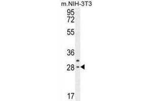 Western Blotting (WB) image for anti-Claudin 22 (CLDN22) antibody (ABIN2995576) (Claudin 22 (CLDN22) antibody)
